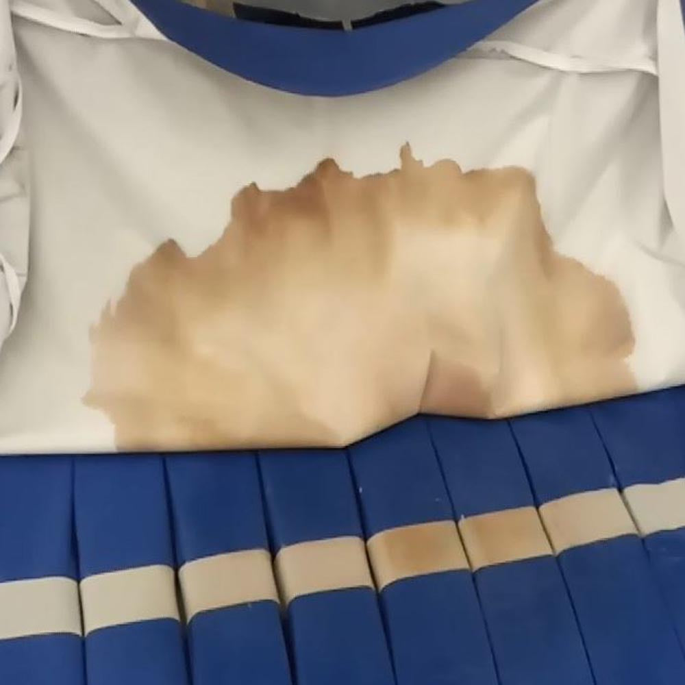 A mattress that is not fit for purpose in a care home